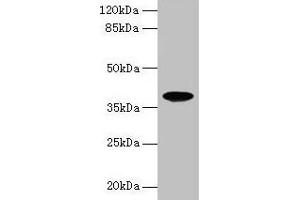 Western blot All lanes: FPR2 antibody at 8 μg/mL + HL60 whole cell lysate Secondary Goat polyclonal to rabbit IgG at 1/10000 dilution Predicted band size: 39 kDa Observed band size: 39 kDa (FPR2 Antikörper  (AA 307-351))