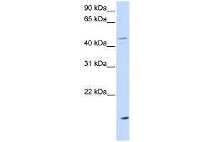 CETP antibody used at 1 ug/ml to detect target protein.