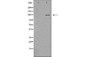 Western blot analysis of Hela whole cell lysates, using MVP Antibody. (MVP Antikörper  (N-Term))