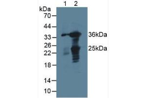 Figure. (GAL4 Antikörper  (AA 1-326))