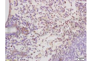 Formalin-fixed and paraffin embedded rat uterus tissue labeled with Anti-SHBG Polyclonal Antibody, Unconjugated (ABIN738771) at 1:200 followed by conjugation to the secondary antibody and DAB staining (SHBG Antikörper  (AA 301-402))