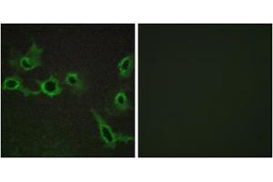 Immunofluorescence analysis of COS-7 cells, using HTR7 antibody. (HTR7 Antikörper  (C-Term))