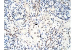 HKR1 antibody was used for immunohistochemistry at a concentration of 4-8 ug/ml to stain Epithelial cells of renal tubule (arrows) in Human Kidney.