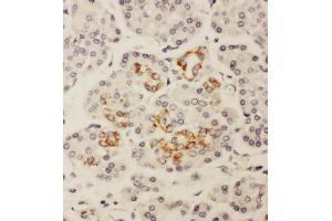 Anti-HOXA3 antibody, IHC(P) IHC(P): Human Pancreatic Cancer Tissue