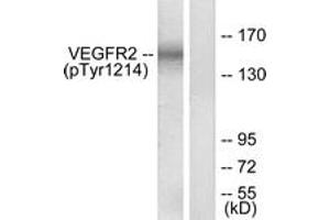 Western blot analysis of extracts from HepG2 cells treated with Na3VO4 0. (VEGFR2/CD309 Antikörper  (pTyr1214))