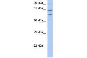 WB Suggested Anti-TMCC3 Antibody Titration:  0.