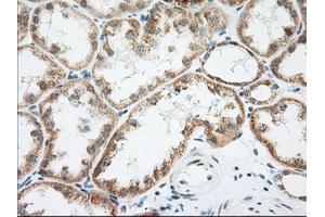 Immunohistochemical staining of paraffin-embedded Human Kidney tissue using anti-LOX mouse monoclonal antibody. (LOX Antikörper  (AA 22-168))