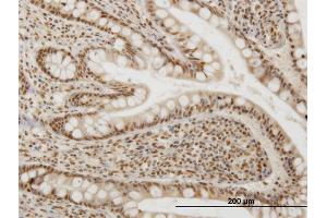 Immunoperoxidase of monoclonal antibody to OXSR1 on formalin-fixed paraffin-embedded human small Intestine. (OXSR1 Antikörper  (AA 351-450))