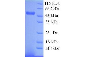SDS-PAGE (SDS) image for Matrix Metallopeptidase 10 (Stromelysin 2) (MMP10) (AA 99-476) protein (His tag) (ABIN7478958)