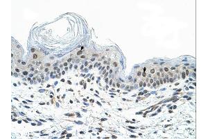 Immunohistochemistry (IHC) image for anti-COP9 Constitutive Photomorphogenic Homolog Subunit 2 (Arabidopsis) (COPS2) (N-Term) antibody (ABIN2780578) (COPS2 Antikörper  (N-Term))