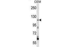 Western Blotting (WB) image for anti-rho Guanine Nucleotide Exchange Factor (GEF) 1 (ARHGEF1) antibody (ABIN2998307) (ARHGEF1 Antikörper)