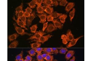Immunofluorescence analysis of HeLa cells using MYO6 Polyclonal Antibody at dilution of 1:100. (Myosin VI Antikörper)