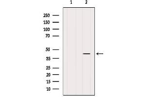 Western Blotting (WB) image for anti-UDP-Gal:betaGlcNAc beta 1,4- Galactosyltransferase, Polypeptide 4 (B4GALT4) (Internal Region) antibody (ABIN6260177)