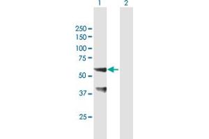 Western Blot analysis of SNX25 expression in transfected 293T cell line by SNX25 MaxPab polyclonal antibody. (SNX25 Antikörper  (AA 1-483))