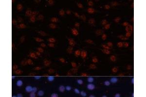Immunofluorescence analysis of C6 cells using TCF4 Polyclonal Antibody at dilution of 1:100 (40x lens). (TCF4 Antikörper)