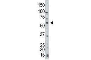 PTEN antibody used in western blot to detect PTEN in HL-60 cell lysate (PTEN Antikörper  (AA 264-295))