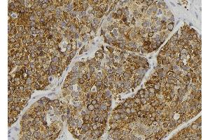 ABIN6279111 at 1/100 staining Human pancreas tissue by IHC-P. (ALMS1 Antikörper  (C-Term))