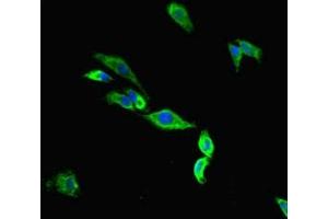 Immunofluorescent analysis of Hela cells using ABIN7172969 at dilution of 1:100 and Alexa Fluor 488-congugated AffiniPure Goat Anti-Rabbit IgG(H+L) (Tmc2 Antikörper  (AA 6-206))