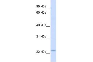 REEP1 antibody used at 1 ug/ml to detect target protein. (Receptor Accessory Protein 1 Antikörper  (C-Term))