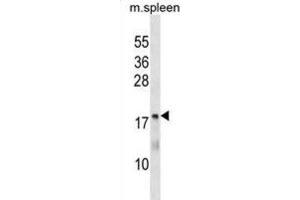 Western Blotting (WB) image for anti-5,10-Methenyltetrahydrofolate Synthetase (5-Formyltetrahydrofolate Cyclo-Ligase) (MTHFS) antibody (ABIN3000360) (MTHFS Antikörper)