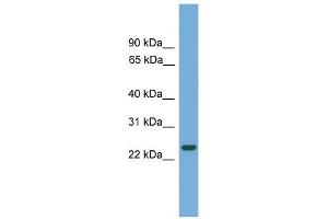 WB Suggested Anti-C19orf18 Antibody Titration: 0. (C19orf18 Antikörper  (N-Term))