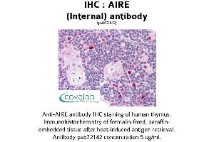 Image no. 1 for anti-Autoimmune Regulator (AIRE) (Internal Region) antibody (ABIN1731636) (AIRE Antikörper  (Internal Region))