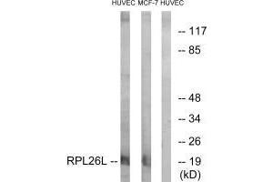 Western blot analysis of extracts from HUVEC cells and MCF-7 cells, using RPL26L antibody. (RPL26L1 Antikörper  (C-Term))
