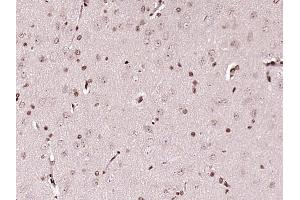 Paraformaldehyde-fixed, paraffin embedded rat brain tissue Antigen retrieval by boiling in sodium citrate buffer (pH6. (C1orf103 Antikörper  (AA 521-620))
