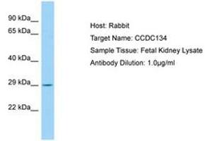 Image no. 1 for anti-Coiled-Coil Domain Containing 134 (CCDC134) (AA 143-192) antibody (ABIN6750168)
