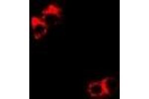 Immunofluorescent analysis of DDX1 staining in Hela cells.
