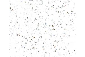 Immunocytochemistry (ICC) image for anti-Insulinoma-Associated 1 (INSM1) (AA 75-125) antibody (ABIN7795670)