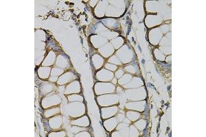 Immunohistochemistry of paraffin-embedded human colon using AZGP1 Antibody (ABIN1876553) at dilution of 1:100 (40x lens). (AZGP1 Antikörper)