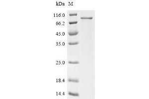 (Tris-Glycine gel) Discontinuous SDS-PAGE (reduced) with 5 % enrichment gel and 15 % separation gel.