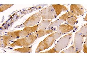 Detection of NRP1 in Human Skeletal muscle Tissue using Monoclonal Antibody to Neuropilin 1 (NRP1) (Neuropilin 1 Antikörper  (AA 646-814))
