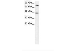 Image no. 1 for anti-Zinc Finger Protein 652 (ZNF652) (AA 97-146) antibody (ABIN6735826) (ZNF652 Antikörper  (AA 97-146))