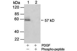 Western blot analysisLane 1: Cell lysate from NIH/3T3 cells stimulated with 50 ng/ml PDGFLane 2: Cell lysate from NIH/3T3 cells stimulated with 50 ng/ml PDGF and blocked with phosphopeptidePrimary Antibody: Rabbit Anti-Akt (Phospho-Ser473) Polyclonal Antibody (ABIN398632) Secondary Antibody: 0. (AKT1 Antikörper  (pSer473))
