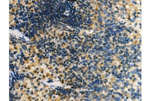 ABIN6261308 and ABIN6276956 at 1/100 staining Rat liver tissue by IHC-P. (DLC1 Antikörper  (N-Term))