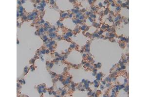 Used in DAB staining on fromalin fixed paraffin- embedded lung tissue (ABCD4 Antikörper  (AA 356-606))