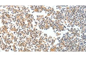 Immunohistochemistry of paraffin-embedded Human tonsil tissue using SPDEF Polyclonal Antibody at dilution 1:60 (SPDEF/PSE Antikörper)