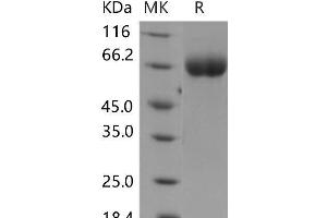 Western Blotting (WB) image for Roundabout, Axon Guidance Receptor, Homolog 4 (ROBO4) protein (His tag) (ABIN7320056)