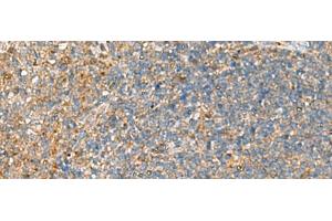 Immunohistochemistry of paraffin-embedded Human tonsil tissue using NQO2 Polyclonal Antibody at dilution of 1:70(x200) (NQO2 Antikörper)