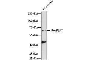 Western blot analysis of extracts of NCI-H460 cells, using tPA/tPA/PLAT antibody (ABIN6128802, ABIN6145743, ABIN6145744 and ABIN6221299) at 1:1000 dilution. (PLAT Antikörper  (AA 23-320))