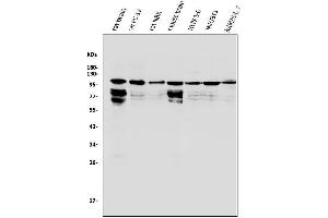 Western blot analysis of HGS using anti-HGS antibody (ABIN7601205). (HGS Antikörper  (AA 3-777))