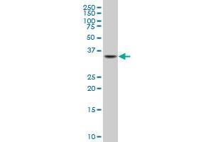 NKX2-5 monoclonal antibody (M03), clone 3A7 Western Blot analysis of NKX2-5 expression in C32 .