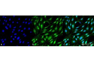 Immunocytochemistry/Immunofluorescence analysis using Mouse Anti-Ubiquitin Monoclonal Antibody, Clone FK2 . (Ubiquitin Antikörper)