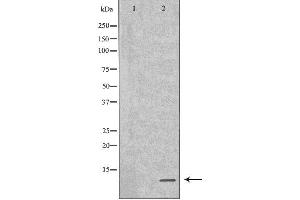 Western blot analysis of GST-SPINK1 recombinant protein using SPINK1 antibody. (SPINK1 Antikörper  (Internal Region))