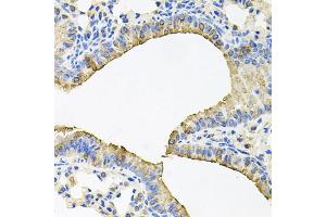 Immunohistochemistry of paraffin-embedded mouse lung using SKAP2 antibody. (SKAP2 Antikörper)