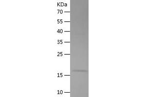 Western Blotting (WB) image for Creatine Kinase, Brain (CKB) (AA 1-125) protein (His tag) (ABIN7122492) (CKB Protein (AA 1-125) (His tag))
