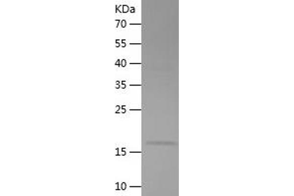 CKB Protein (AA 1-125) (His tag)