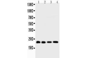 Western Blotting (WB) image for anti-BH3 Interacting Domain Death Agonist (BID) (AA 1-195) antibody (ABIN3042321)